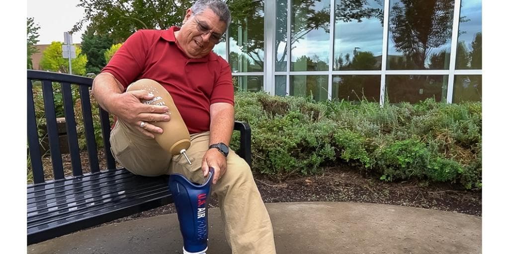VA prosthetic socket image